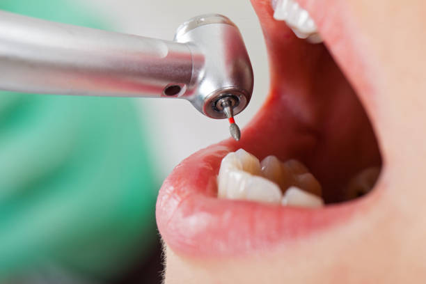 Best Pediatric Emergency Dentist in Amherst, OH